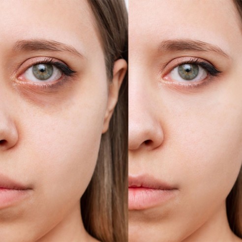 Concealer stick 1 Llorca -Face -Elisabeth Llorca