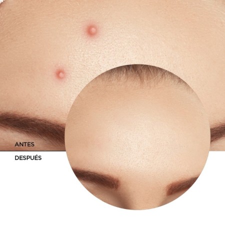 Revox Zitcare AHA-BHA-PHA – 25 ml -Crèmes et sérums -Revox B77 2