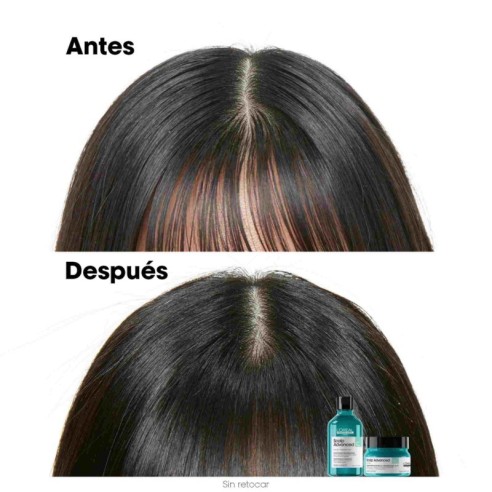 L'Oréal Professionnel Shampooing Anti-Graisse Avancé pour Cuir Chevelu 300 ml -Gros -L'Oreal