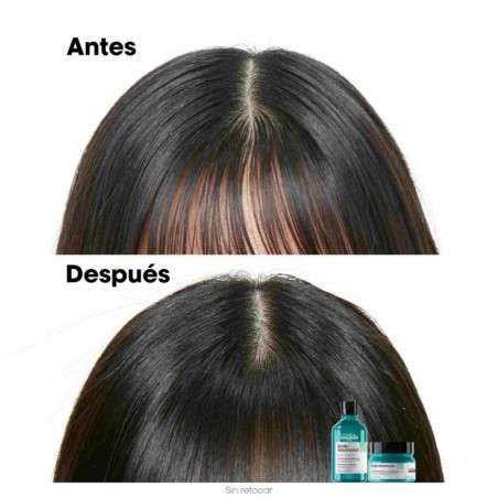 Shampoo antigrasso avanzato per cuoio capelluto L'Oréal Professionnel 300 ml -Grasso -L'Oreal