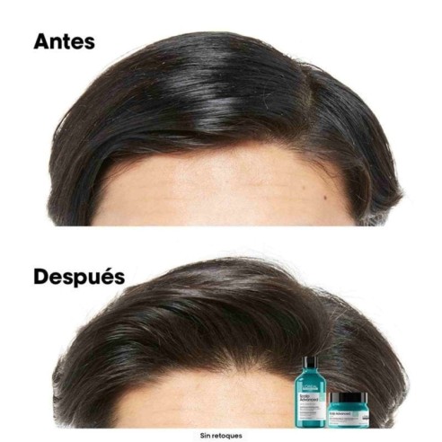Champú Scalp Advanced Anti-Grasa L'Oréal Professionnel 300ml -Grasa -L'Oreal